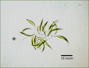Ankistrodesmus sp. Сах.Головкаред.4а, Балаклавский район, пос. Сахарная Головка, Sevastopol (Russia)