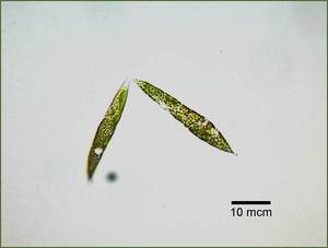 Ankistrodesmus sp. FACHB ред.6, г. Ухань, Провинция Хэбэй (КНР)